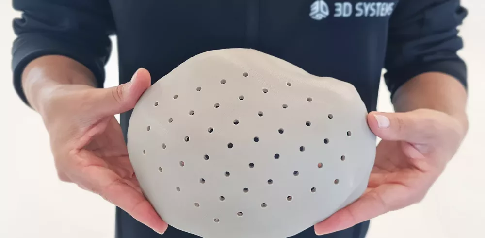 3D Systems’ Extrusion Technology to Produce Patient-specific PEEK Implants