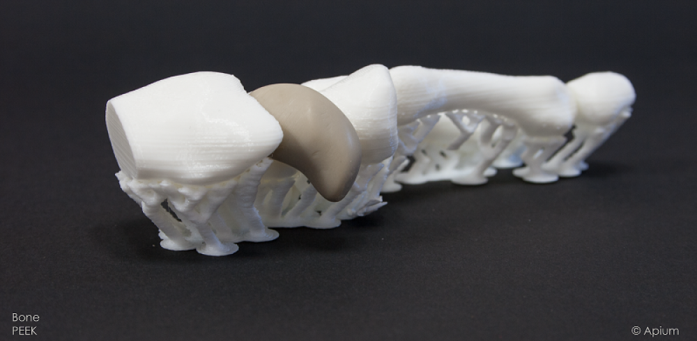 3D Printing Supports the Health Sector