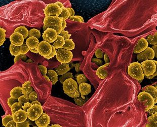 Computer program tackles antibiotic resistance