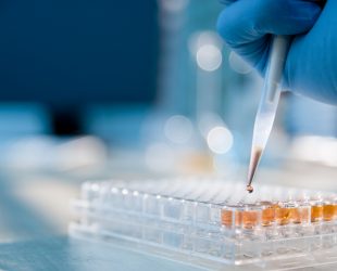 Lab technician injecting liquid into a microtiter plate