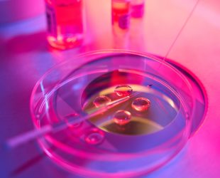 The Future of Liquid Biopsy