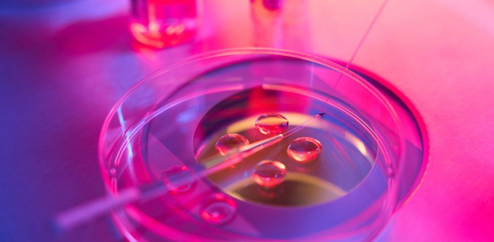 Biotechnological,Embryo,Biopsy,Procedure,In,A,Modern,Laboratory