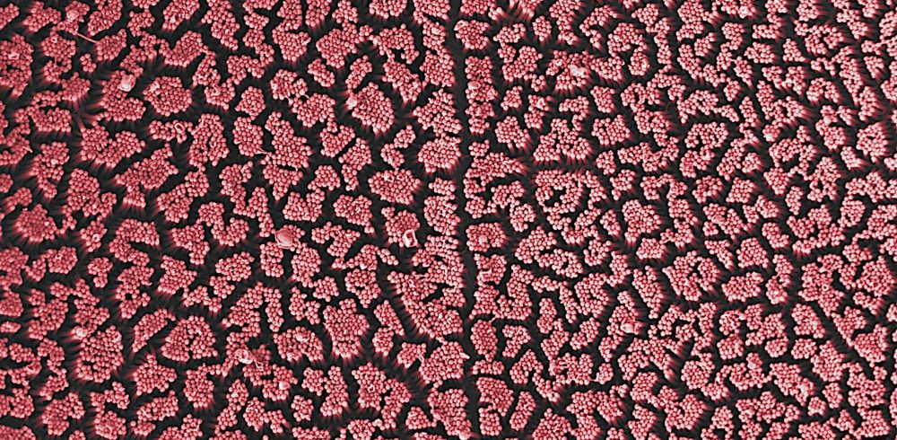 SEM and XPS complement each other