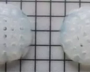 Queen’s Researchers Create New 4D Printed Implants for Efficient Breast Cancer Management